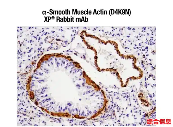 揭秘Windows XP：全面剖析系统的起源发展与功能特点